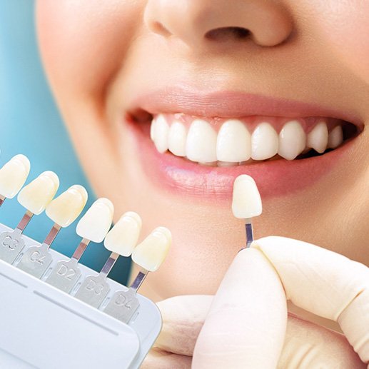 a dentist holding up a shade chart to a patient’s teeth to determine their color