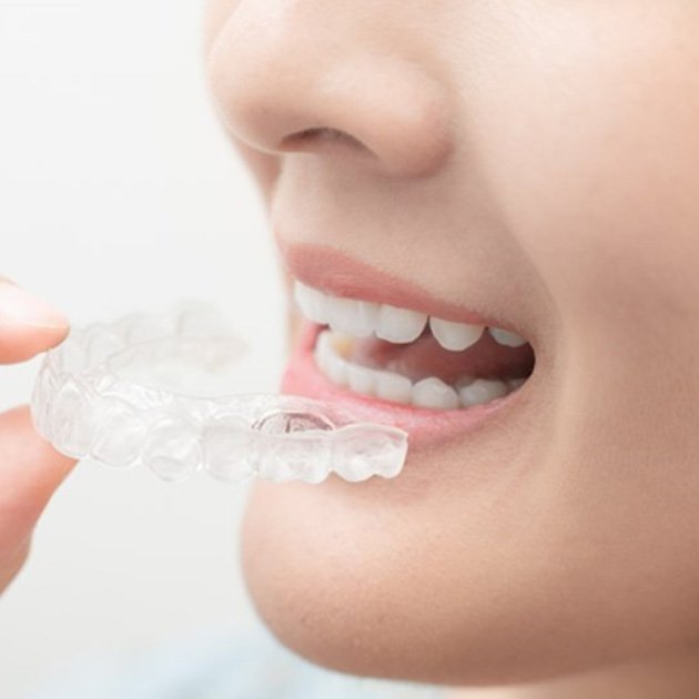 a person easily taking off their Invisalign aligner