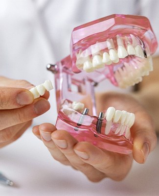 Hands holding a sample implant bridge in a translucent pink base
