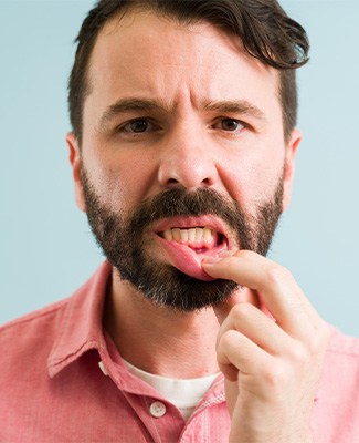 Man pulling down lower lip to reveal dark red gums