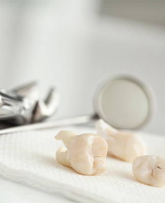 Closeup of extracted molars on a piece of gauze next to dental instruments