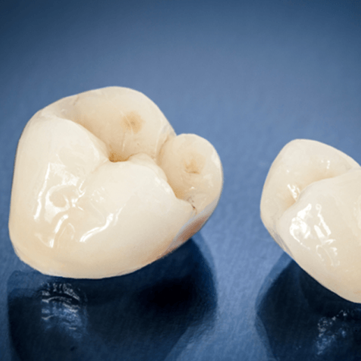 A closeup of ceramic dental crowns on a reflective surface